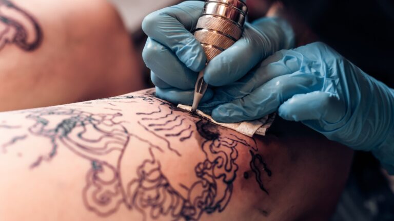 na-czym-polega-laserowe-usuwanie-tatuazu
